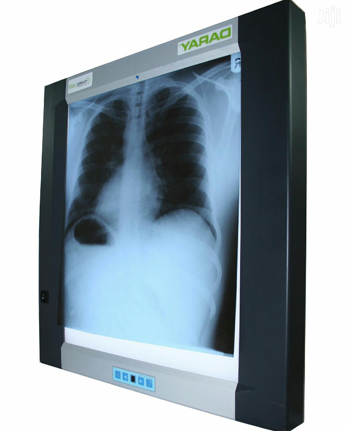 X-RAY VIEWER